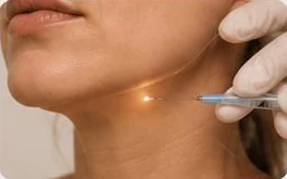 Endolift
