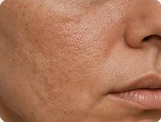 Textura e qualidade da pele